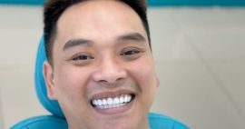 Chi phí bọc răng sứ nguyên hàm bao nhiêu? Bảng giá mới nhất