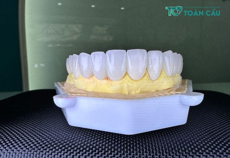 Làm răng sứ ở đâu tốt sử dụng răng sứ, vật liệu chất lượng