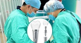 Nên trồng Implant loại nào tốt nhất hiện nay?