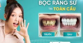 Bọc sứ cho răng đã lấy tủy có được hay không?