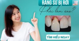 Răng sứ bị rơi ra phải xử lý như thế nào?