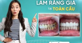 Làm răng giả ở đâu tốt và tối ưu ngân sách tại TP. HCM