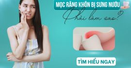 Mọc răng khôn bị sưng nướu và đau nhức nên làm thế nào?