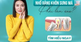 Nhổ răng khôn bị sưng má bao nhiêu lâu thì hết?