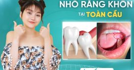 Nhổ răng khôn có sưng không? Những điều cần lưu ý