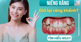 Niềng răng có thể giữ lại răng khểnh được hay không?