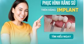 Phục hình răng sứ trên Implant là gì? Và những điều cần lưu ý