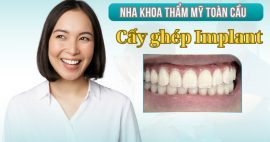 Trồng răng Implant có gây hôi miệng không? Nguyên nhân là gì