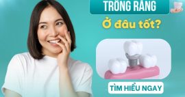 Trồng răng loại nào tốt nhất? Ưu nhược điểm từng loại