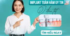 Đánh giá nha khoa trồng răng implant toàn hàm Gò Vấp uy tín