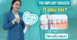 Trụ implant Hiossen là gì? Có đắt không? Ở đâu tốt?