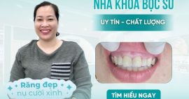 Nha khoa bọc sứ gò vấp uy tín không phải ai cũng biết