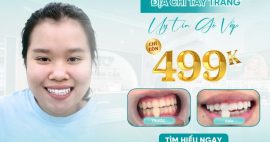 Địa chỉ tẩy trắng răng gò vấp chỉ từ 499k - Khám phá ngay!