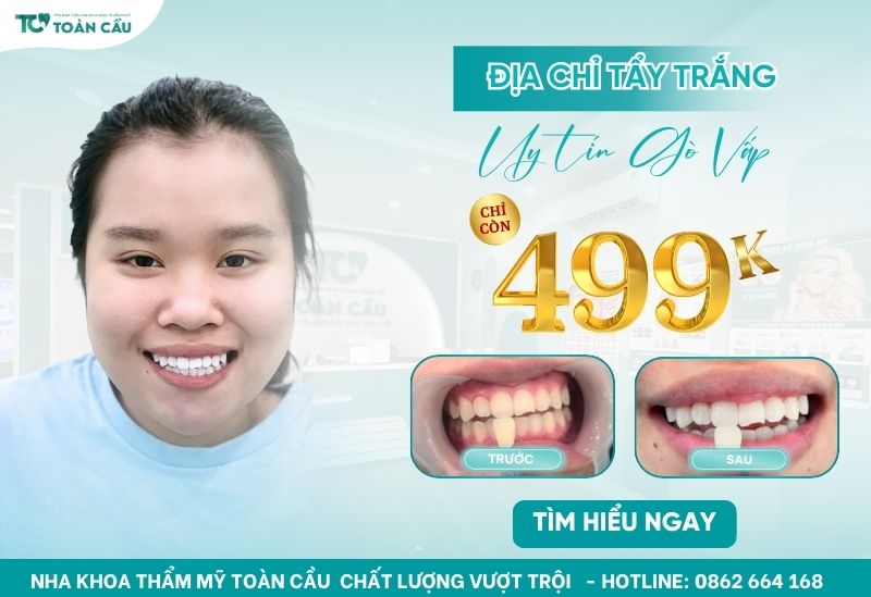 Địa chỉ tẩy trắng răng gò vấp chỉ từ 499k - Khám phá ngay!