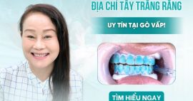 địa chỉ tẩy trắng răng Gò Vấp uy tín