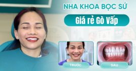 Khám phá nha khoa bọc sứ giá rẻ Gò Vấp chất lượng cao
