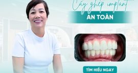 Nha khoa cấy ghép implant gần đây? Đến ngay với Toàn Cầu
