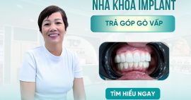 Địa chỉ Nha khoa implant trả góp Gò Vấp ở đâu?