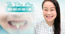 Đâu là địa chỉ tẩy trắng răng gần đây với dịch vụ tẩy trắng bằng công nghệ ánh sáng