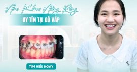 nha khoa niềng răng Gò Vấp uy tín