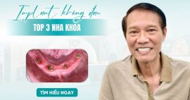 Review top 3 nha khoa trồng răng implant không đau tại Gò Vấp
