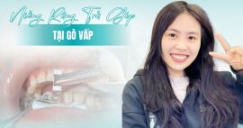 Top 3 nha khoa niềng răng trả góp Gò Vấp có lãi suất ưu đãi