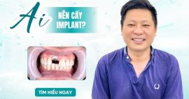Những ai nên trồng răng implant?