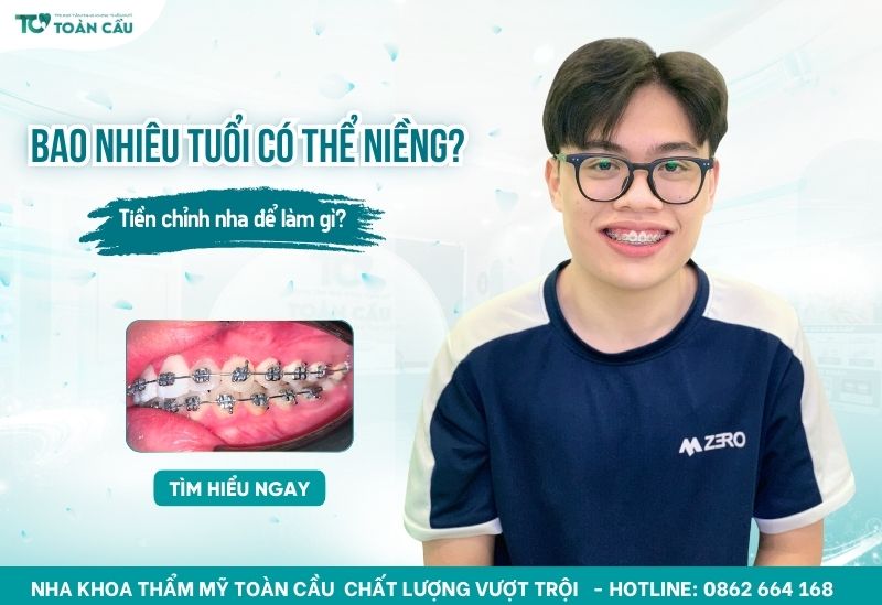 bao nhiêu tuổi có thể niềng răng