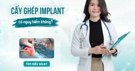 Cấy ghép Implant có nguy hiểm không