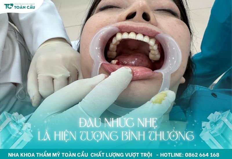 Có thể đau nhức ngay sau khi cấy ghép