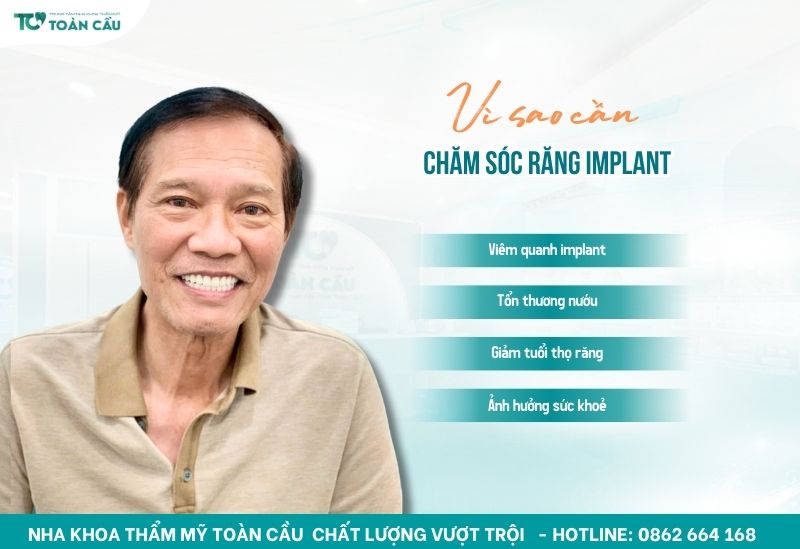 Hướng dẫn chăm sóc răng implant sau khi trồng để đảm bảo độ bền lâu dài 5 Vì sao cần chăm sóc răng implant sau khi trồng?