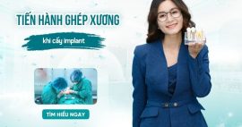 ghép xương trong trồng răng implant