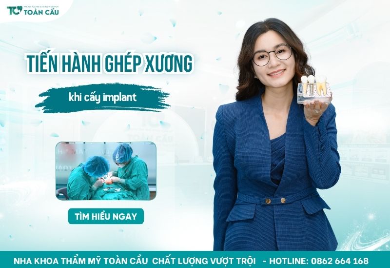 ghép xương trong trồng răng implant