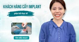 khách hàng đã trồng răng implant