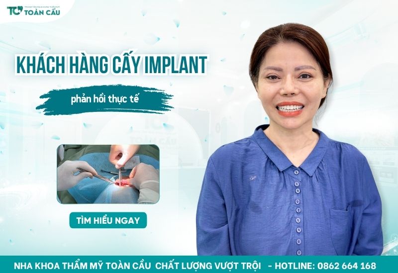 khách hàng đã trồng răng implant