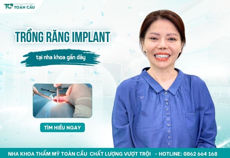 nha khoa trồng răng implant gần đây