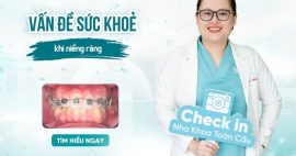 niềng răng có ảnh hưởng đến sức khỏe không