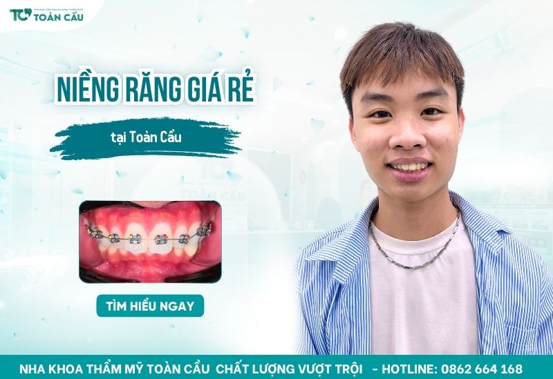 niềng răng giá rẻ có thực sự hiệu quả