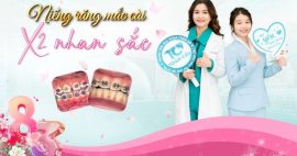 Niềng răng mắc cài kim loại tại Gò Vấp