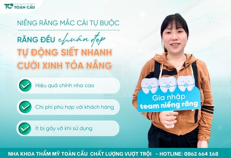 Niềng răng mắc cài tự buộc là gì? Ưu điểm và giá thành ra sao? 5 Niềng răng mắc cài tự buộc là gì?