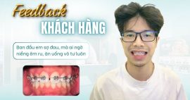 Niềng răng tại phòng khám uy tín Gò Vấp