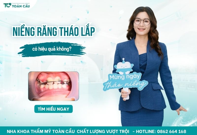 niềng răng tháo lắp có hiệu quả không