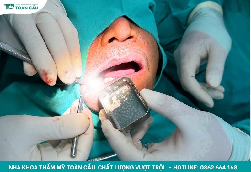 Khách hàng chia sẻ: “Tôi đã tự tin hơn sau khi trồng răng implant” 7 Cấy ghép implant tại Nha khoa Thẩm mỹ Toàn Cầu