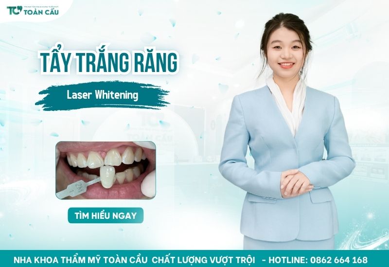 tẩy trắng răng bằng laser tại Gò Vấp