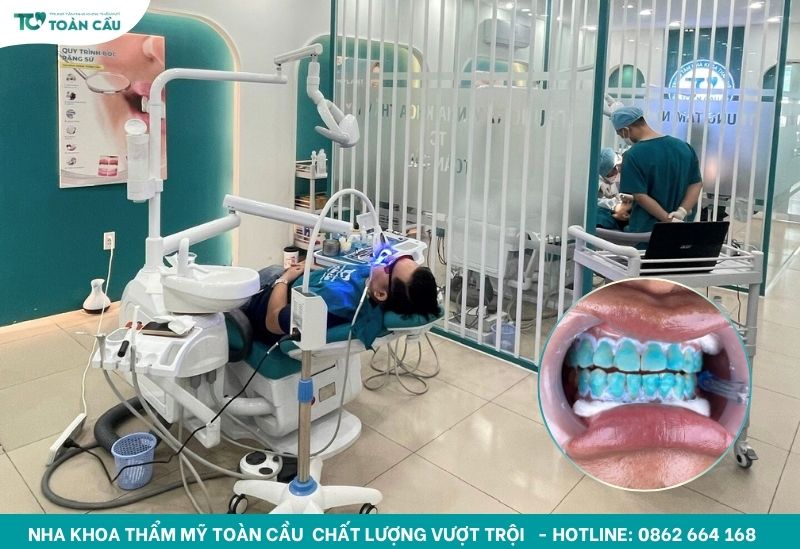Tẩy trắng răng bằng laser tại Gò Vấp ở đâu uy tín? 7 Bước 4: Bôi thuốc và chiếu tia laser