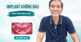 trải nghiệm trồng răng implant không đau