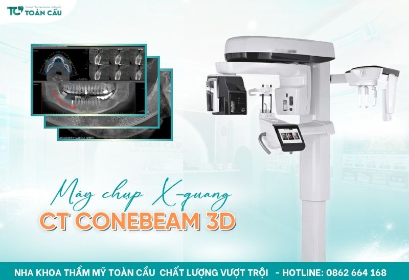 Trồng răng implant không đau và uy tín tại Gò Vấp - Lựa chọn hoàn hảo cho nụ cười khỏe đẹp 5 Máy chụp X-quang CT ConeBeam 3D