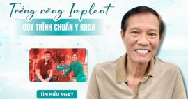 trồng răng implant là gì