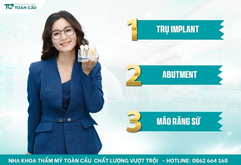 Các loại trụ implant phổ biến – Nên chọn loại nào tốt nhất? 5 Cấu tạo trụ Implant gồm những gì?