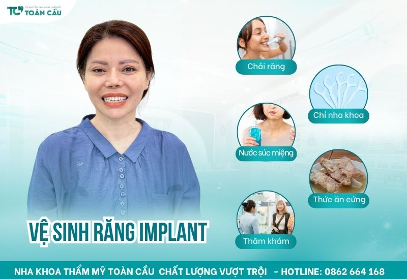 Cách vệ sinh răng Implant đúng cách